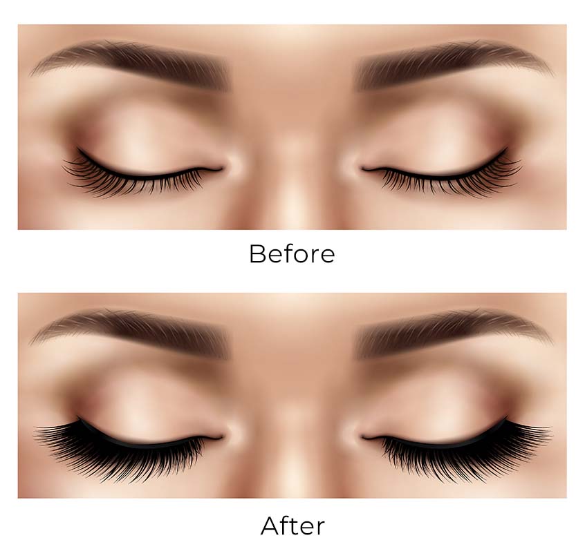 Before and After Classic Lash Extensions